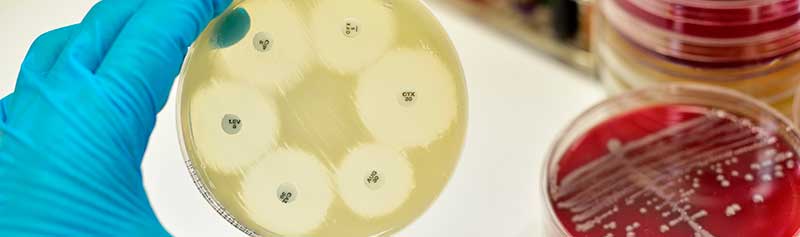Validación Microbiológica para la Valoración de Antibióticos por Método de Cilindro Placa