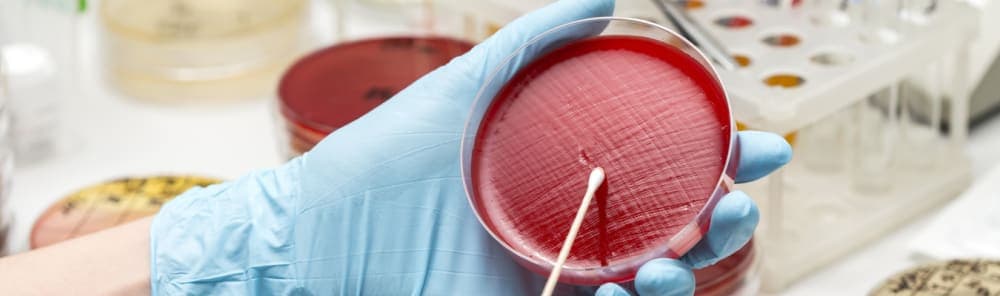Validación de Métodos Microbiológicos (Límites Microbianos, Esterilidad y Endotoxina)